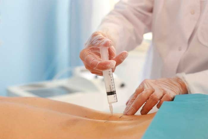 Revolución en Estética: El poder del Ozono y sus resultados comprobados