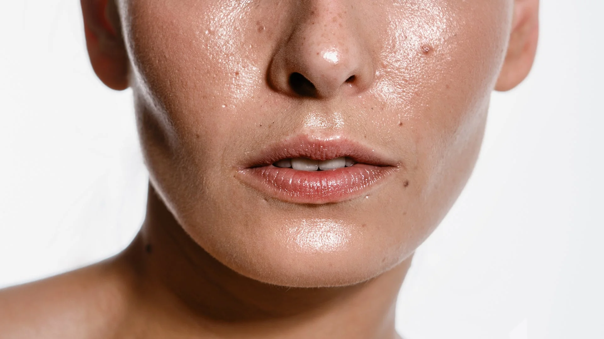 Workshop Online: El poder de los ácidos en pieles seborreicas