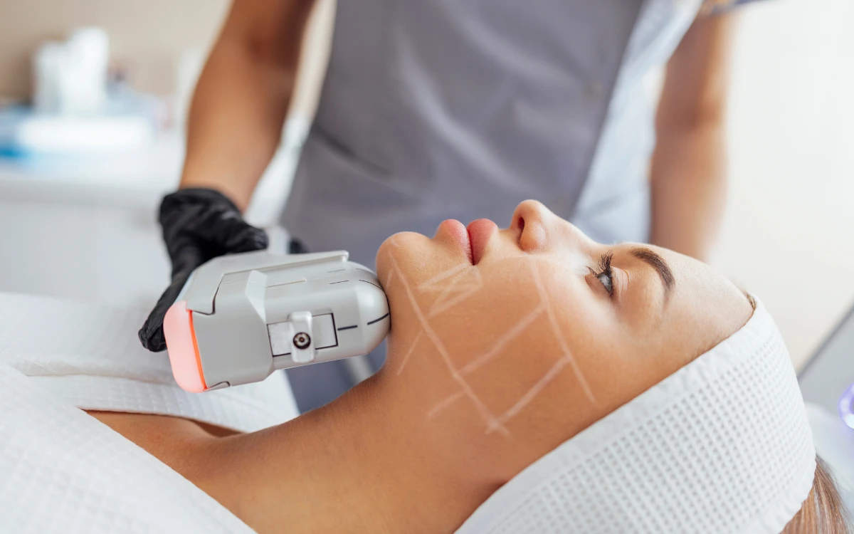 Workshop Rejuvenecimiento Facial con HIFU